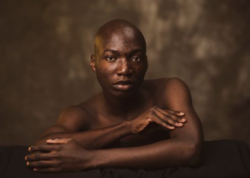 Studio portrait of a bald young man with freckles, showcasing natural beauty and expression.