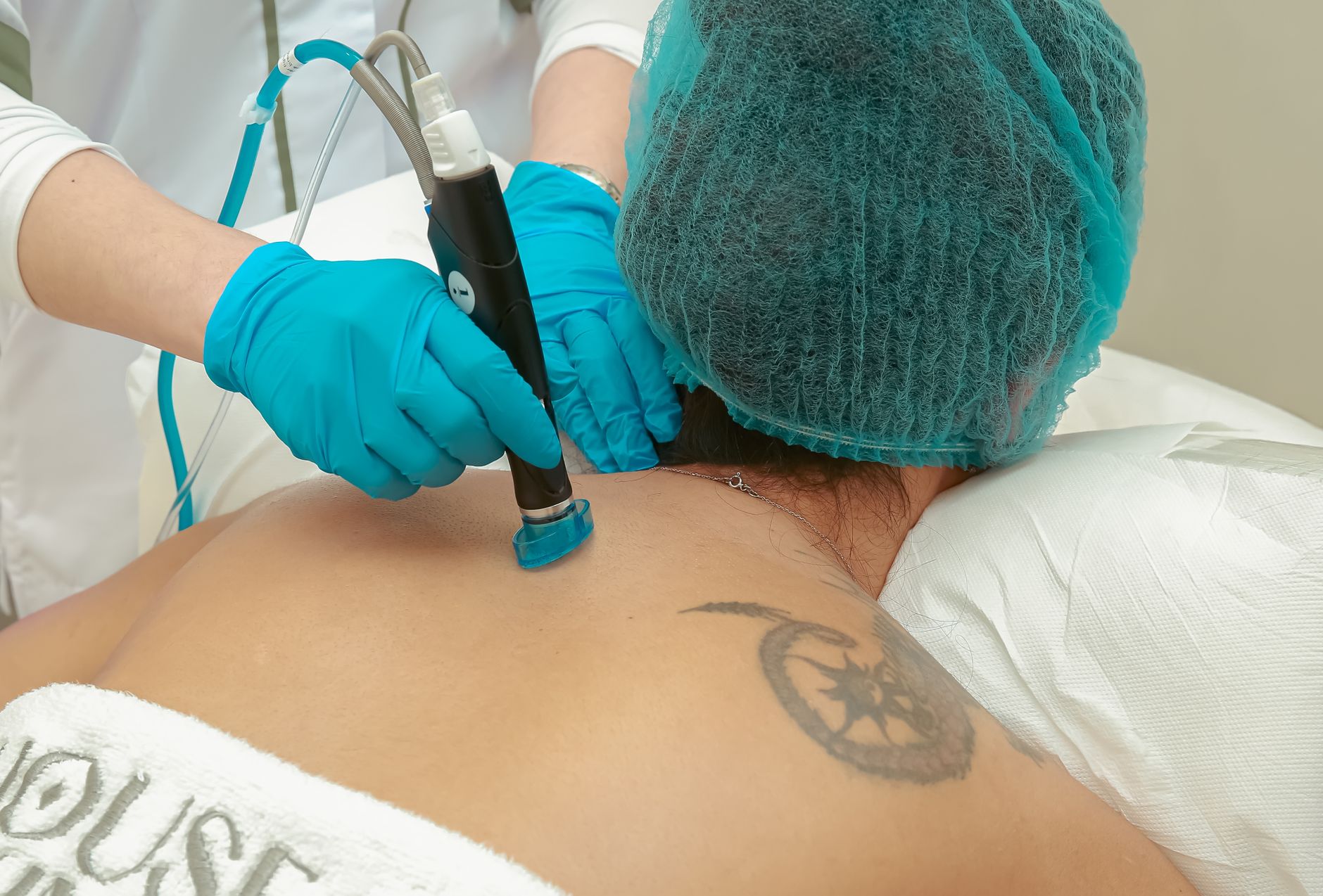 Back view of a medical professional using laser equipment on patient for skincare treatment.