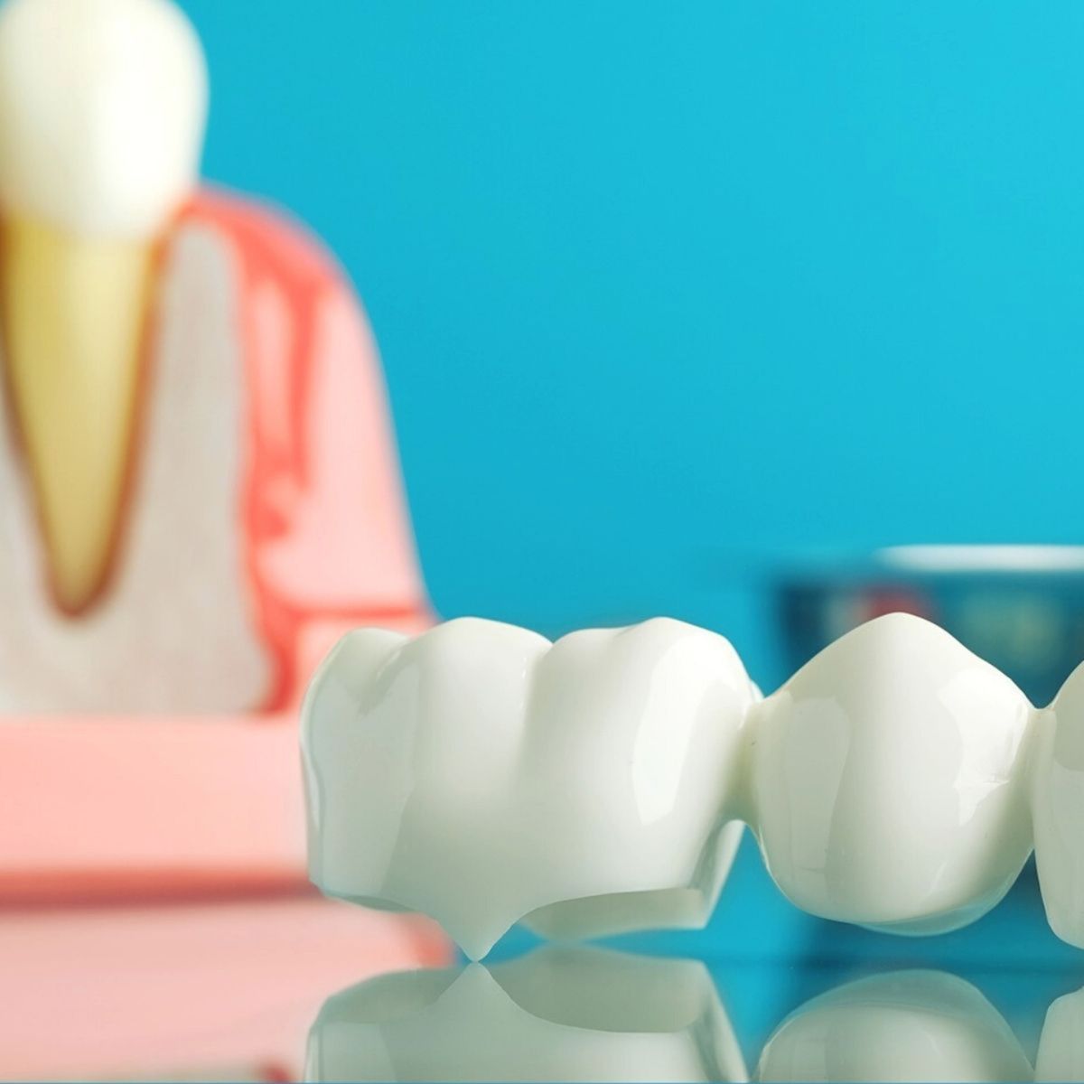 Dentist examining an older dental filling with a mirror