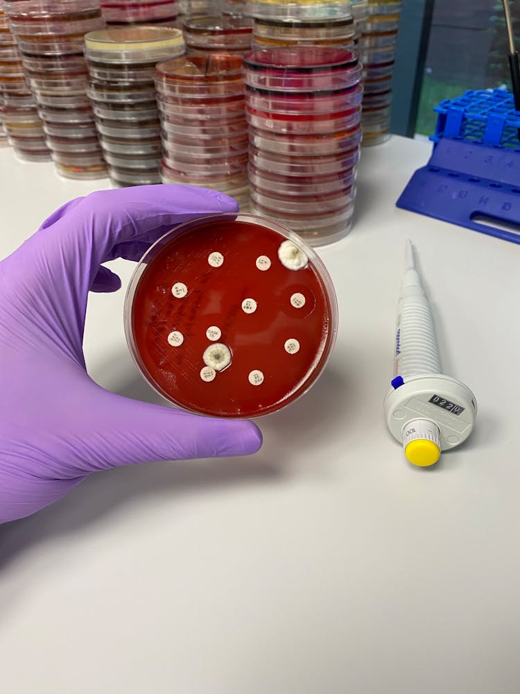 Hand In Glove Holding Petri Dish