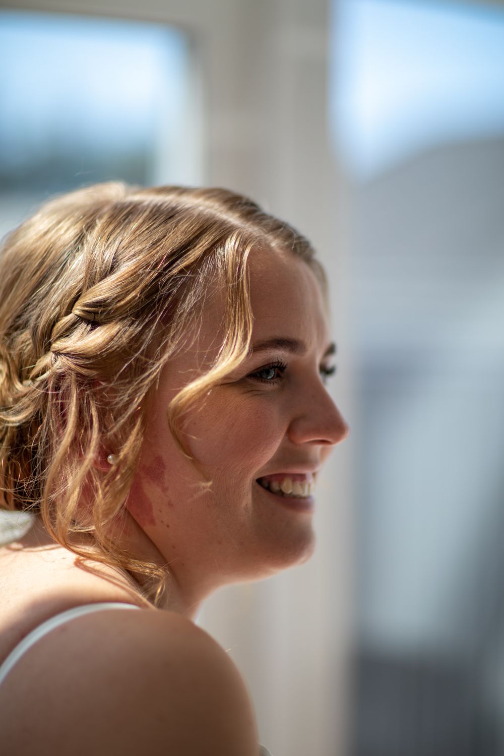 A bright, confident smile after veneers at NW1 Dental Care