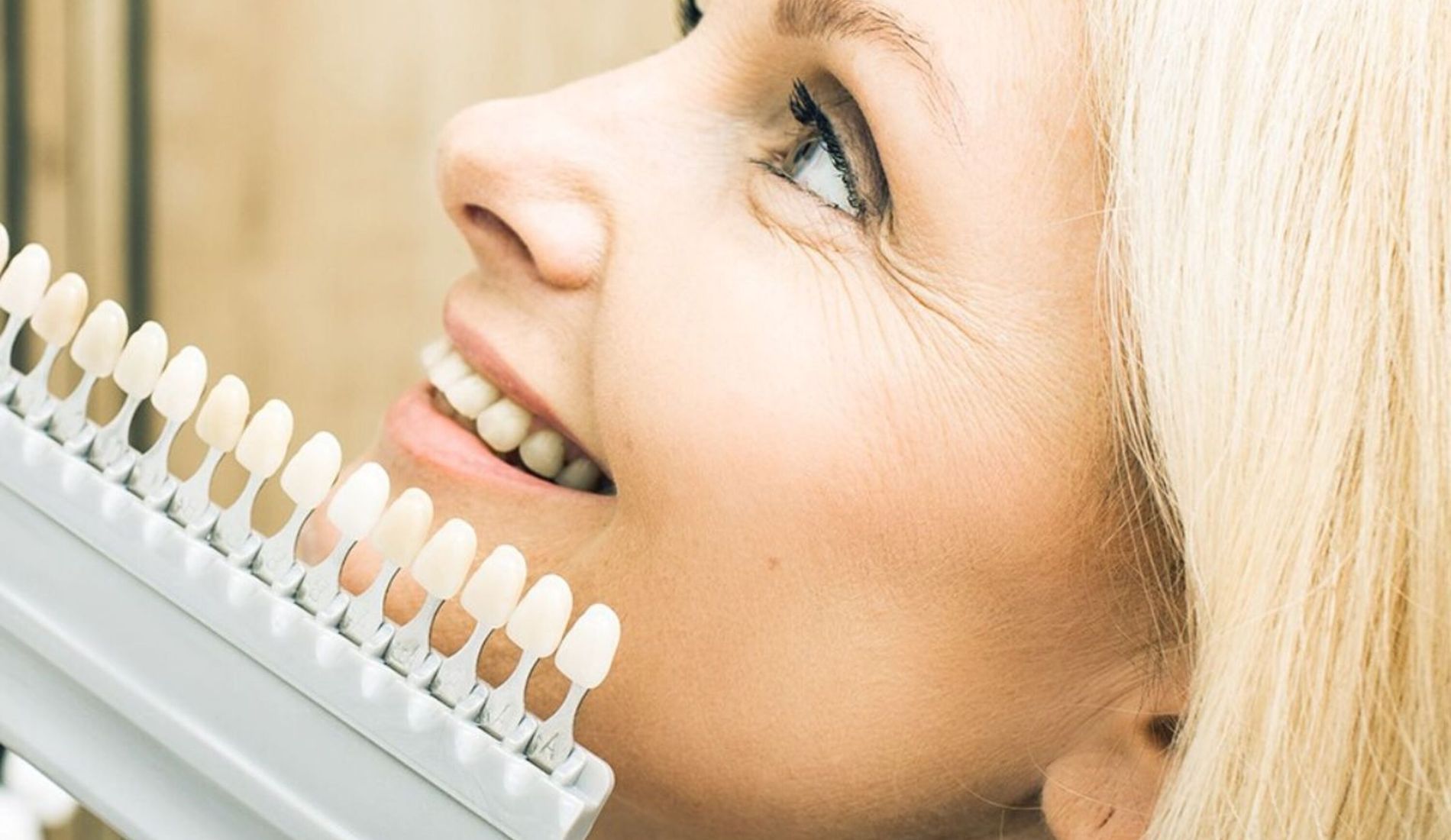 Dental Veneers