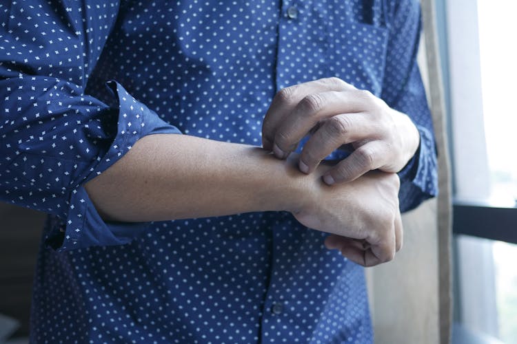 Close Up Of Hand Scratching Arm