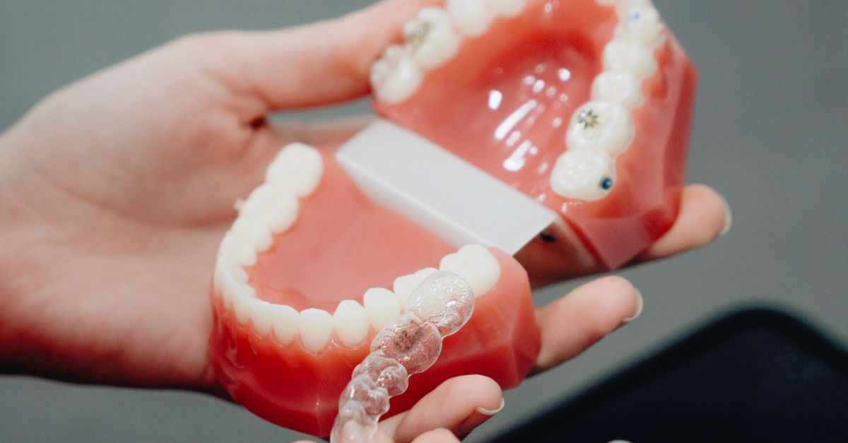 How Myobrace® Can Help Guide Natural Jaw Growth and Prevent Braces in Children