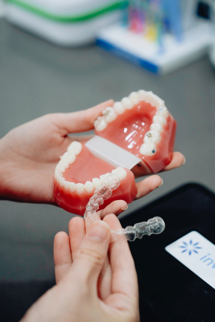 Hands Of A Person Holding Clear Retainers And Teeth Mould