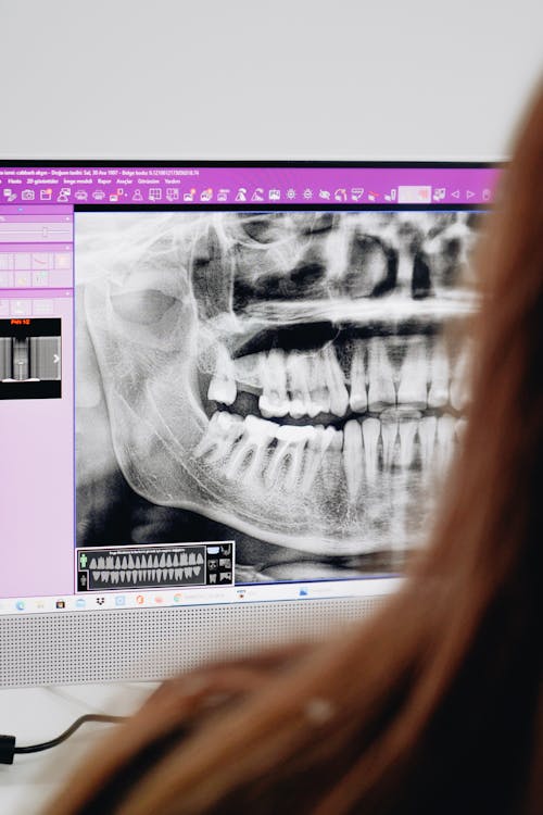Close-up of a Woman Looking a Dental X-ray 