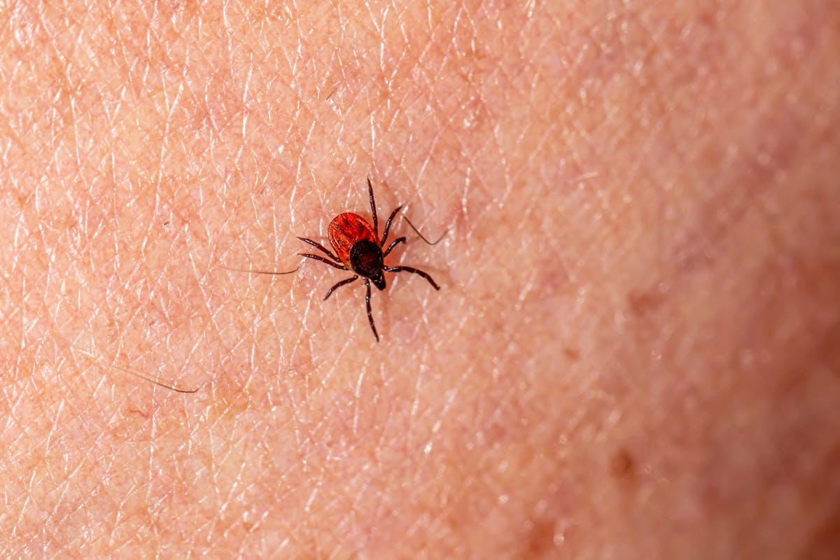 Deer tick on skin — Lyme disease Long Island
