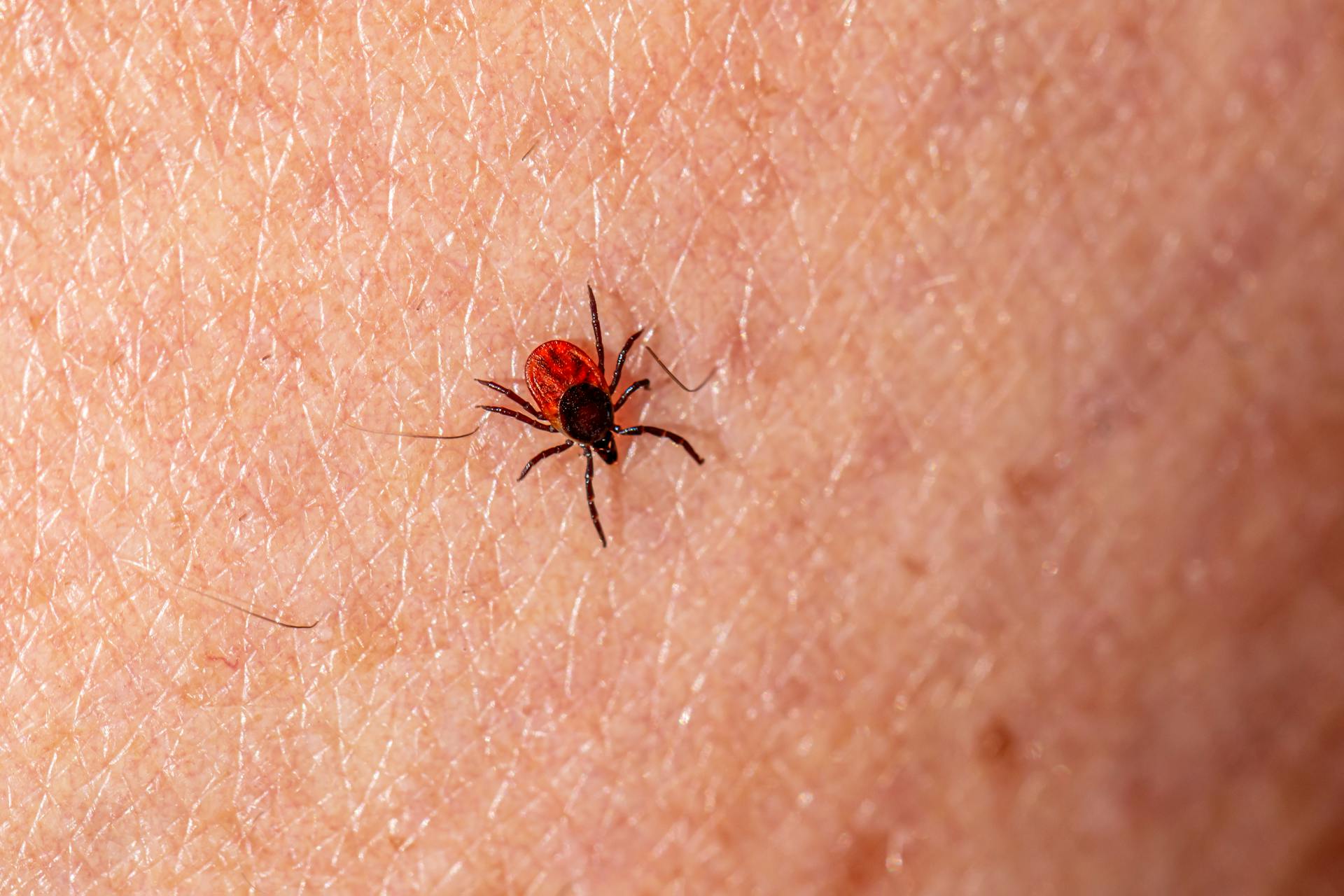 Macro Photography of a Sheep Tick on a Skin