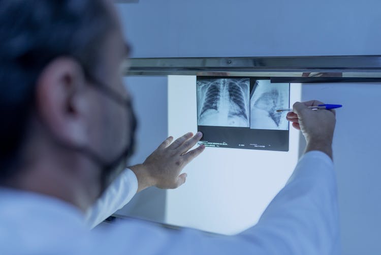 Doctor Looking At An X-ray Result