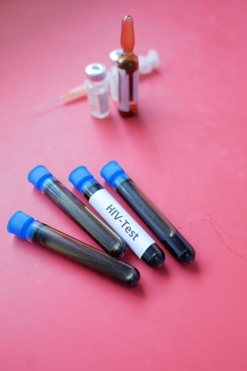 Free Four HIV test blood samples in vacutainers against a pink background. Medical and laboratory concept. Stock Photo