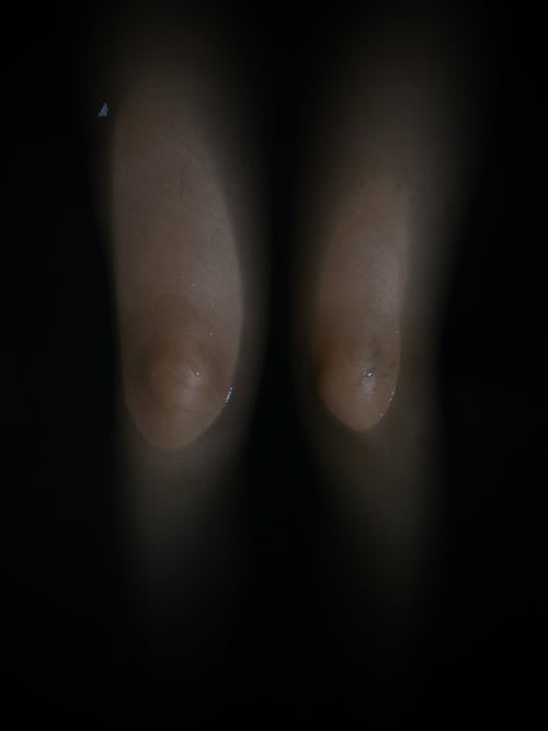 Close Up Photo of Knees