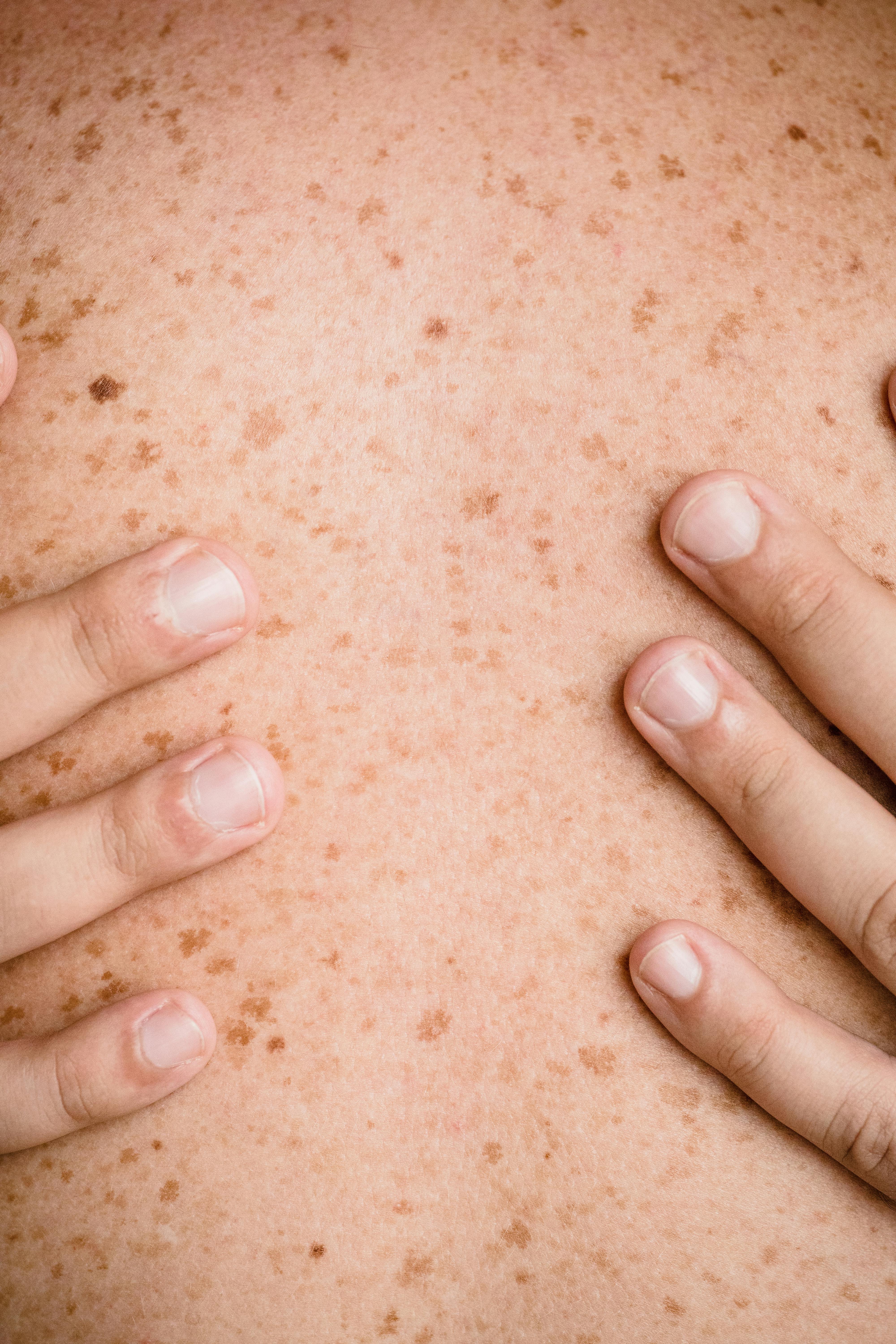 close up of hands touching persons bare freckled back