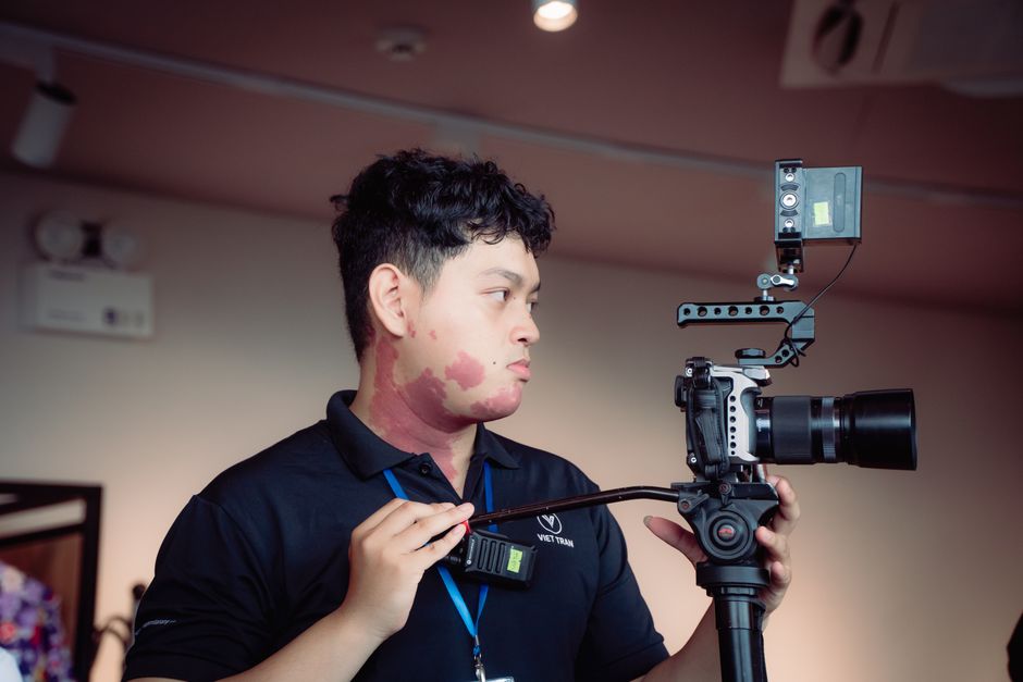 出生時のあざを持つ若い写真家が屋内でプロフェッショナルなカメラを操作しています。