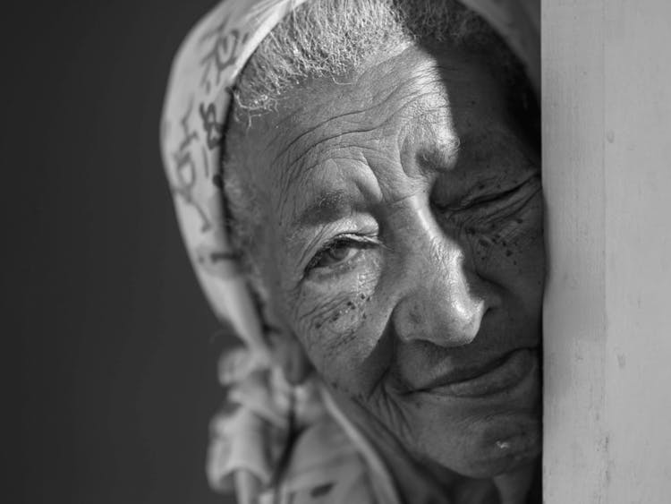 Moles On Elderly Woman's Face