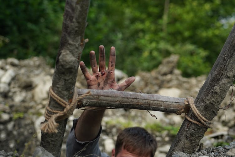 Dirty And Hurt Hand On Ladder