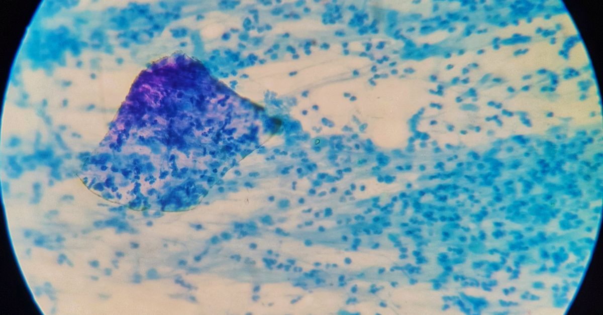 Micro Organisms under Microscope · Free Stock Photo