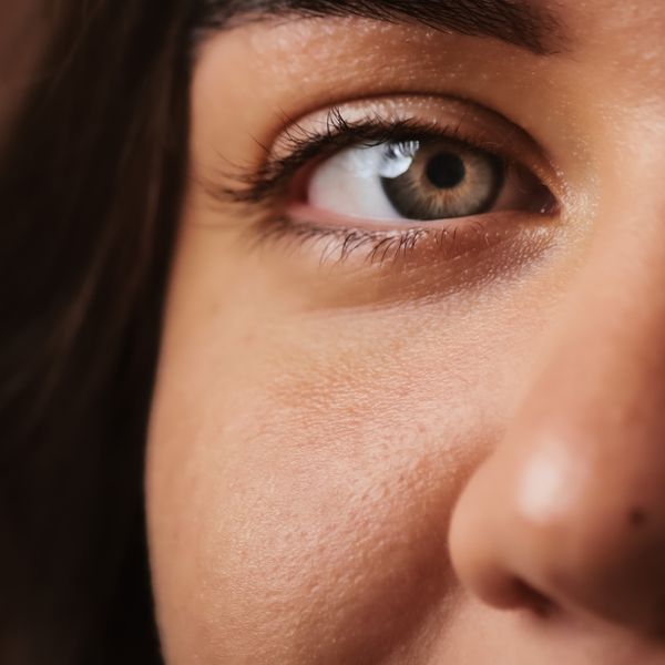 Cheek texture after treatment