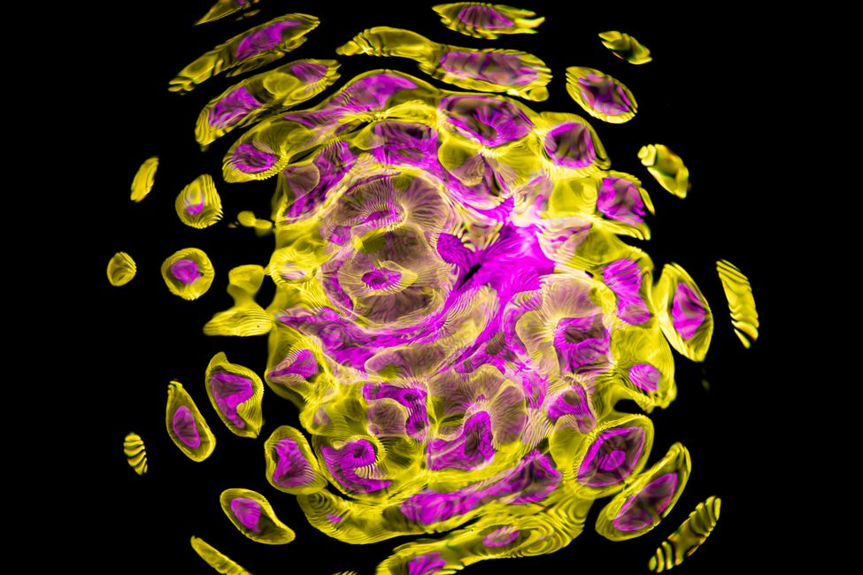 brain scan colorful patterns