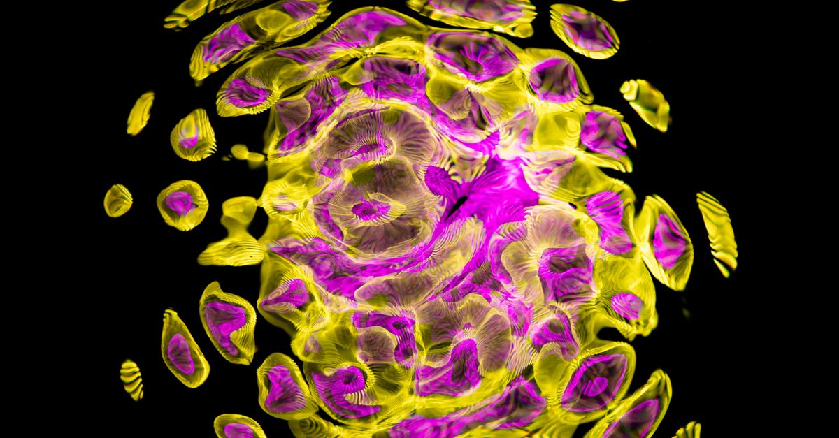 Stryker and IAGE Collaborate on Fluorescence-Guided Surgery in India