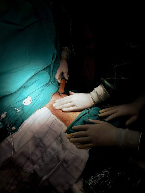 Δωρεάν στοκ φωτογραφιών με ασθενής, ιατρικό όργανο, κατακόρυφη λήψη
