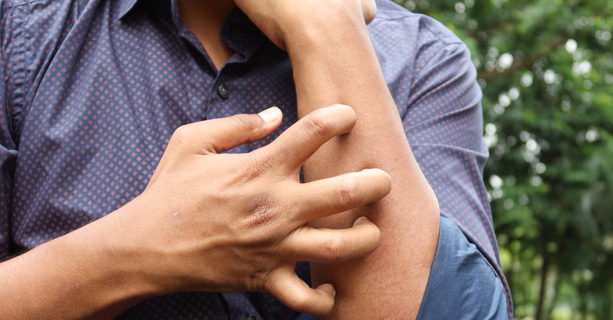 Unpacking the Global Surge in Allergy Cases