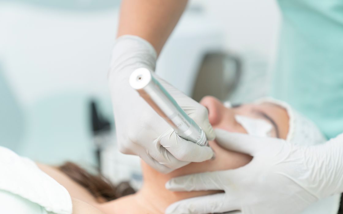 Close-up of a cosmetic treatment being performed in a clinical environment.