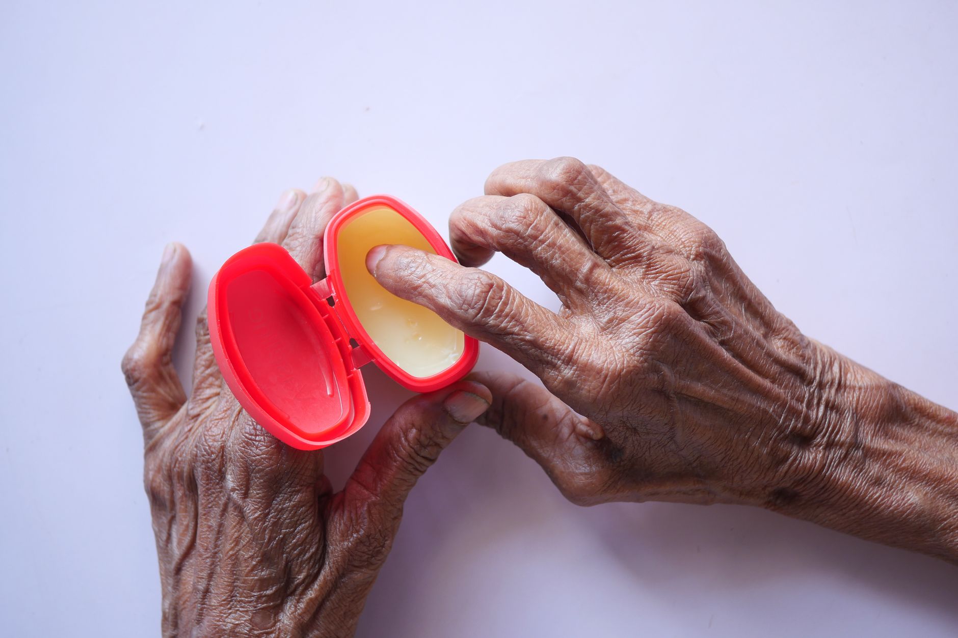 Using cannabis cream and balm for localized pain relief Medical cannabis patient applying cannabis topicals for pain at home