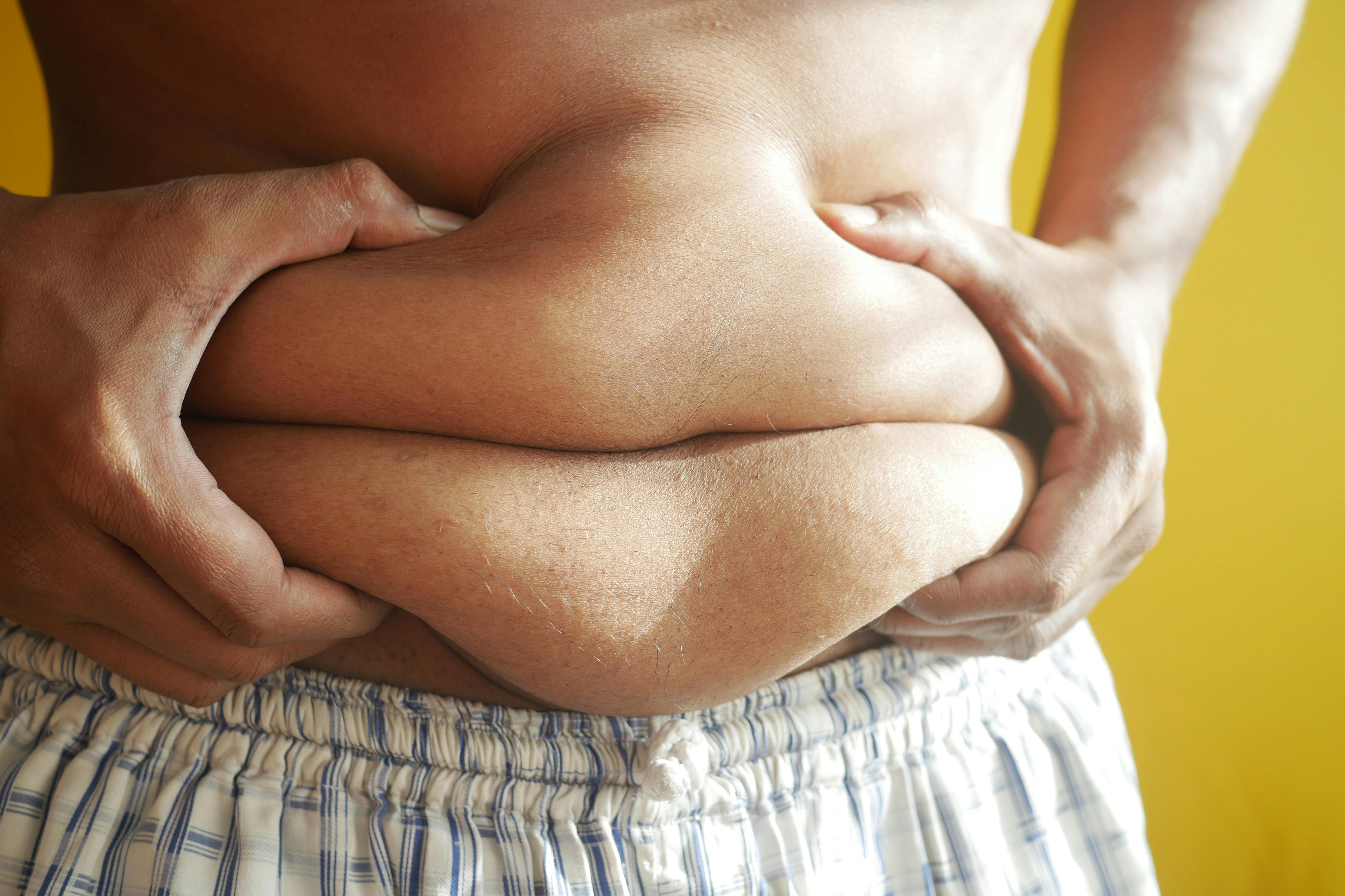 A Person Holding on to Belly Fat · Free Stock Photo