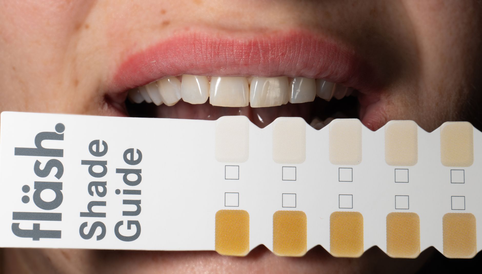 Dental Cosmetic - Denwest Dental Clinic Dental Cosmetic in تورنهیل، انتاریو, - چگونه اضطراب دندانپزشکی در تورنهیل، انتاریو را کاهش دهیم؟