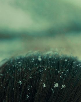 Detailed shot of snowflakes resting on dark hair, capturing a serene winter moment.