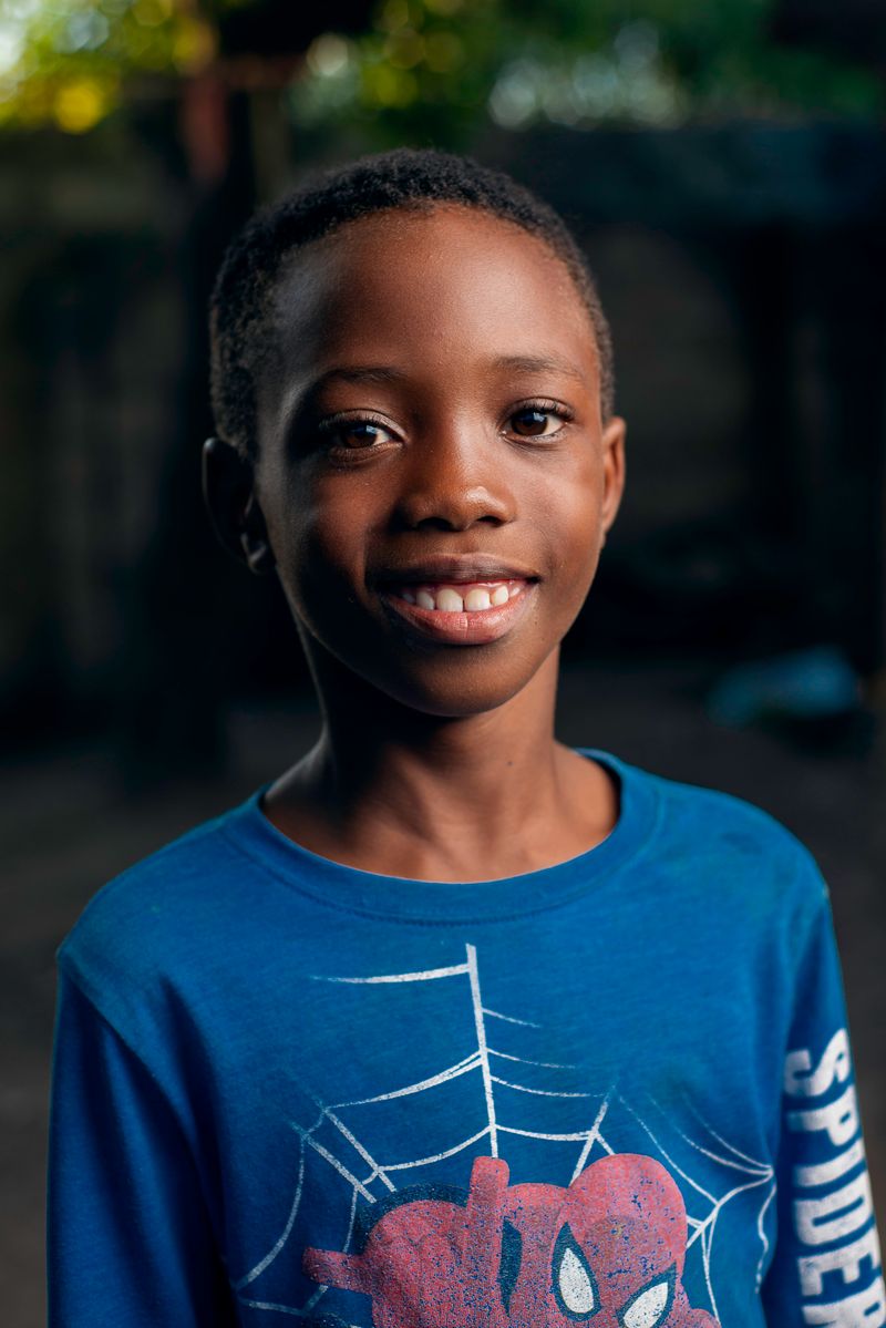 A young Black boy with short, closely cropped hair, his scalp and hairline visible. Scalp ringworm (tinea capitis) is most common in Black children and is often mistaken for dandruff or dry scalp.