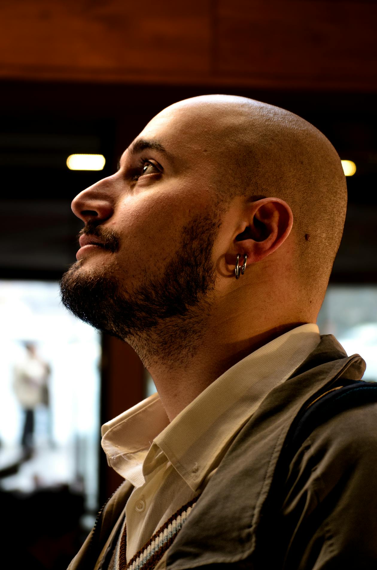 Side view showing male hairline recession