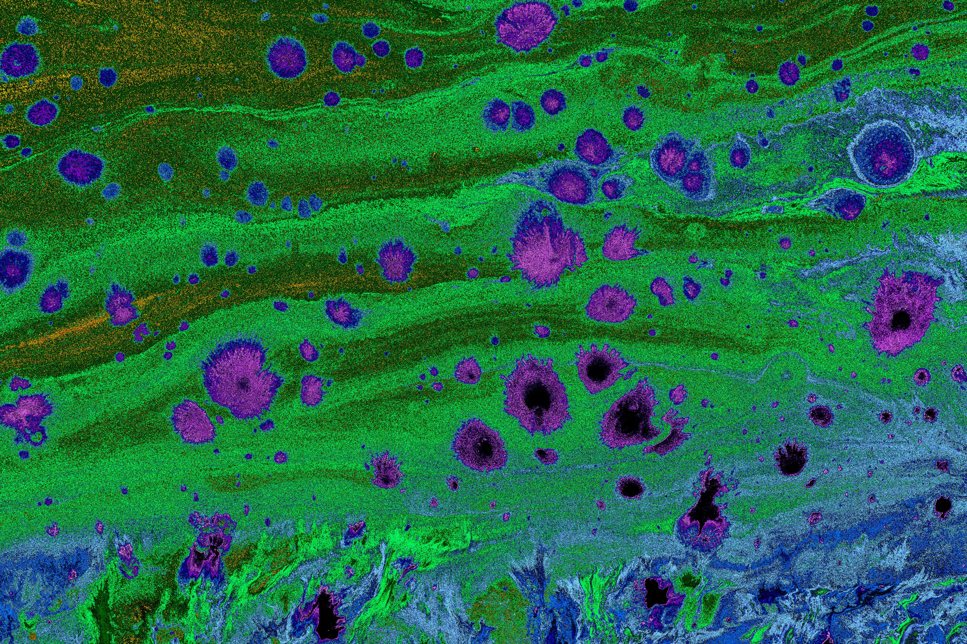 NIH funds brain PET imaging technology — Photo by Turgay Koca on Pexels