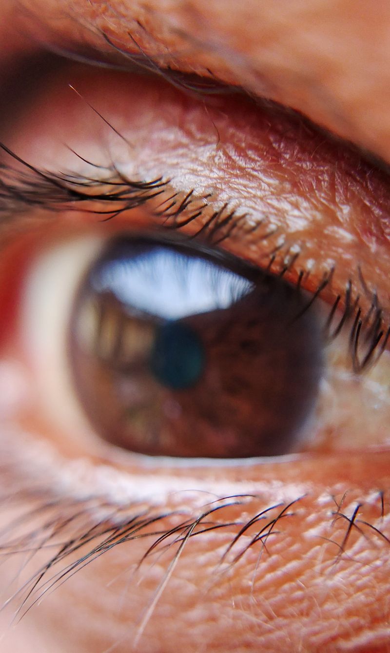 Eye Bag Treatment