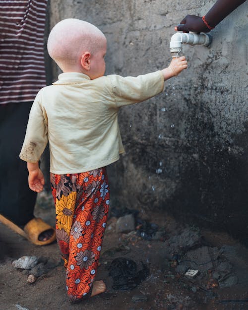 Imagine de stoc gratuită din albinos, băiat, chel