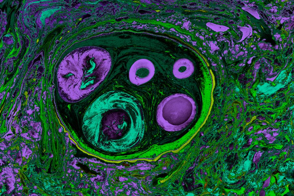 NIH backs MD Anderson with USD 3m grant to validate tumor prediction NAMs in CRC trials
