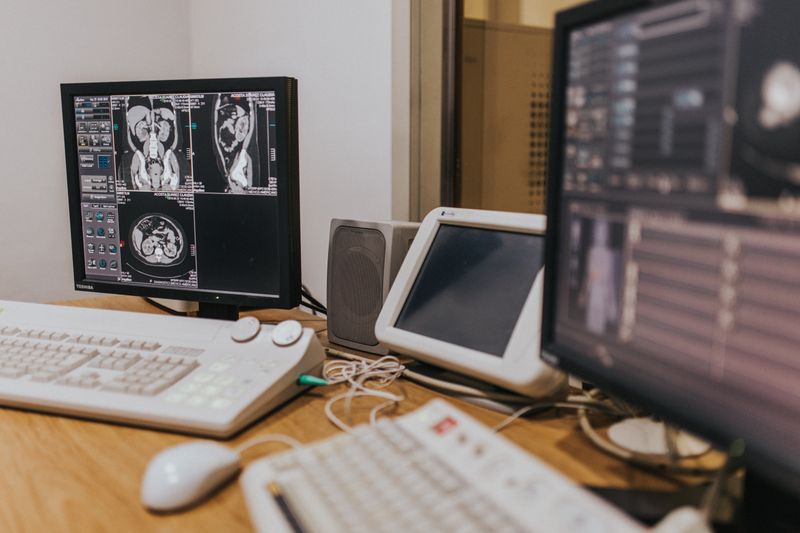 AI 用 CT 自動標注抓早期肺癌:2026 之後醫療影像產業鏈怎麼重排? AI 用 CT 自動標注抓早期肺癌:2026 之後醫療影像產業鏈怎麼重排?