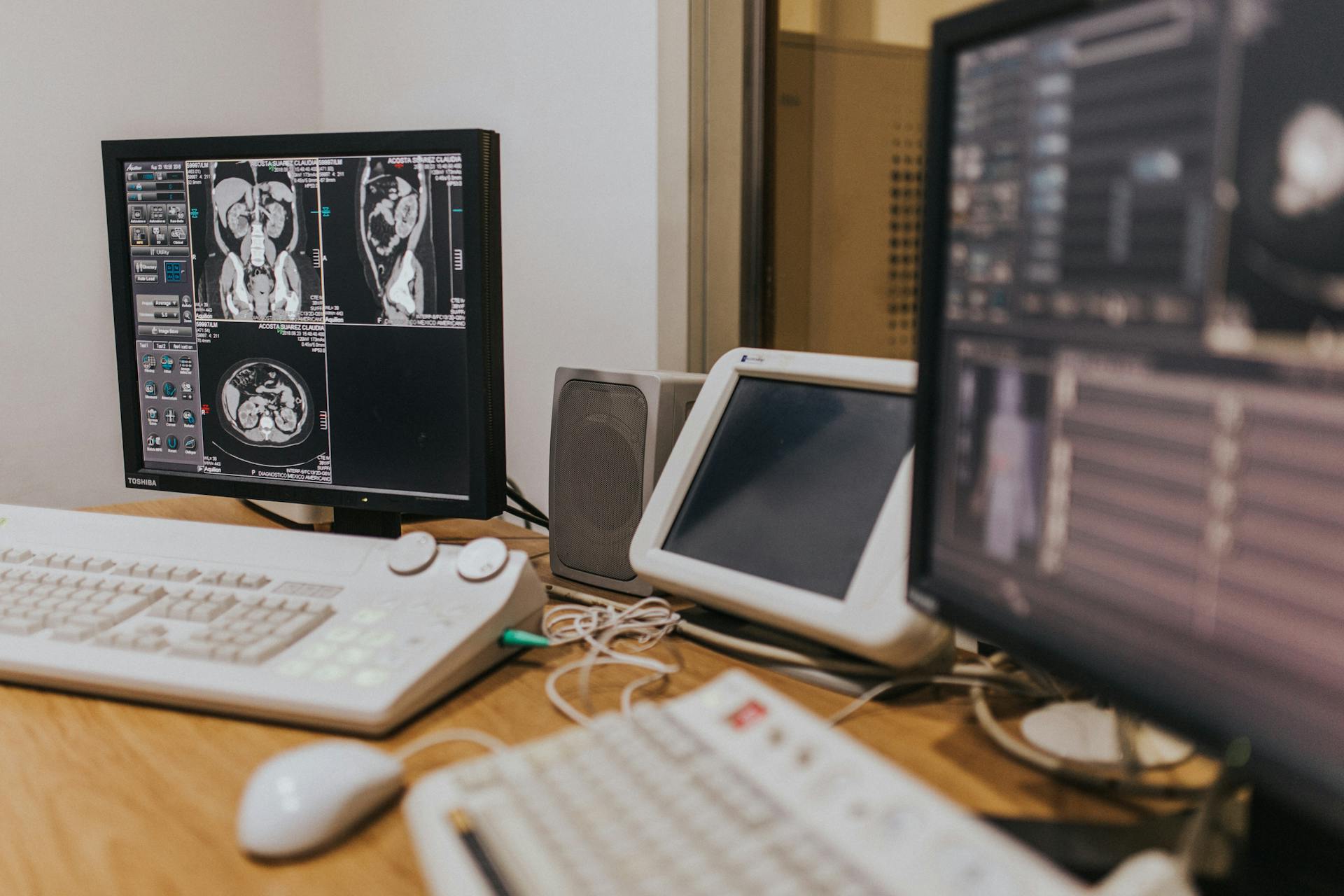 Medical imaging setup with MRI scans on multiple screens in a healthcare facility.