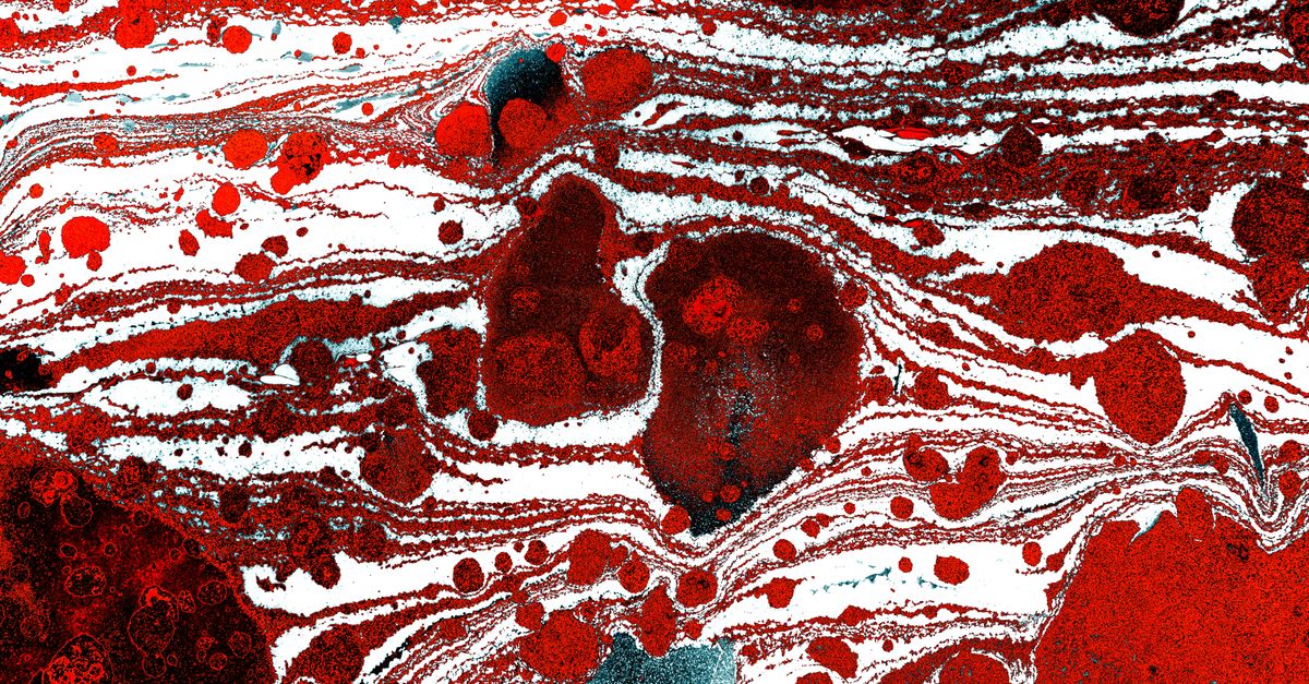 AI-enabled pathology slide digitization projects