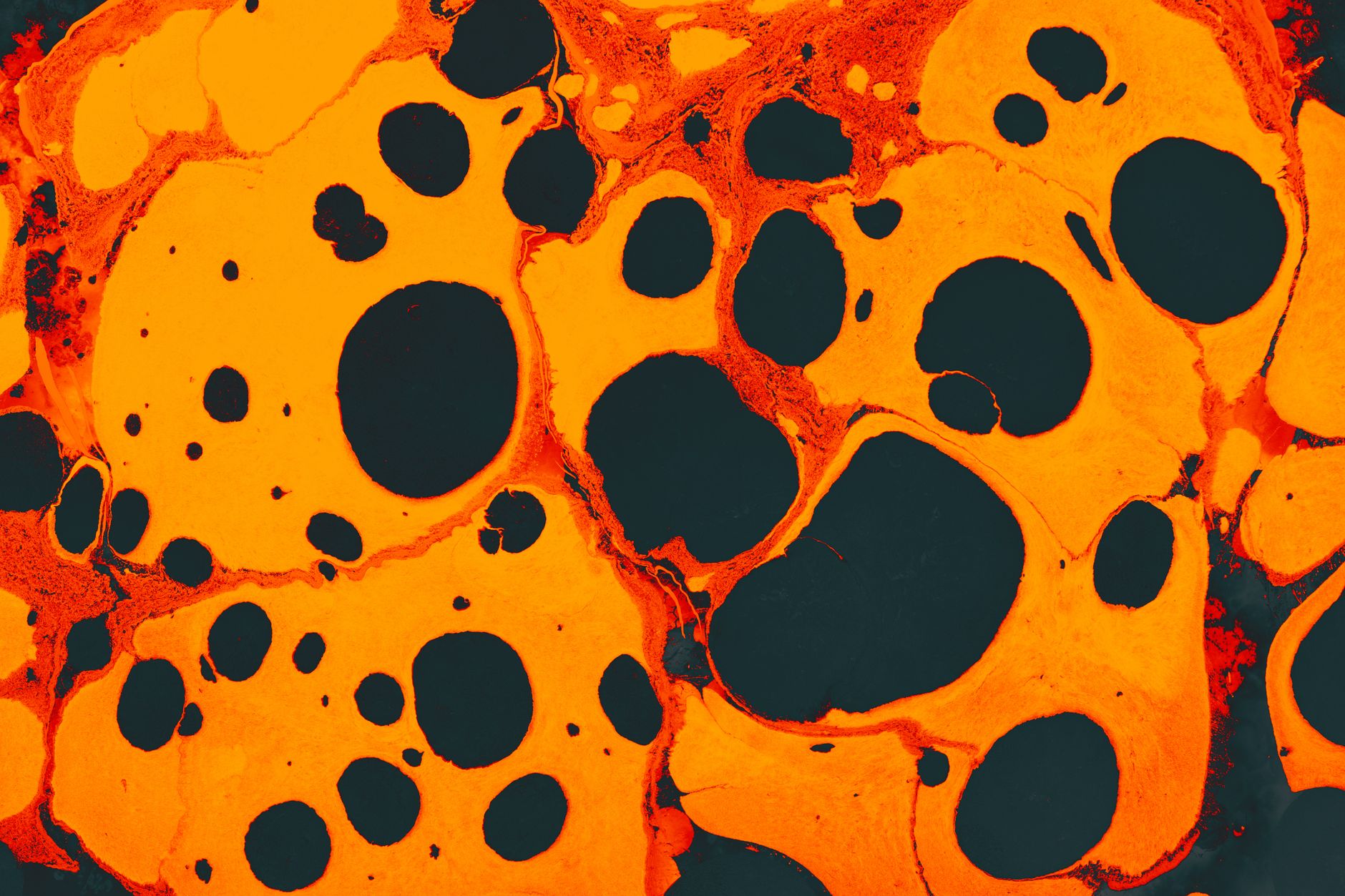Endometrial repair: Why ALDH HI cells are the missing piece