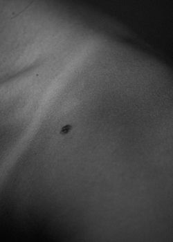 Close-up black and white photo highlighting texture and beauty spot on skin.