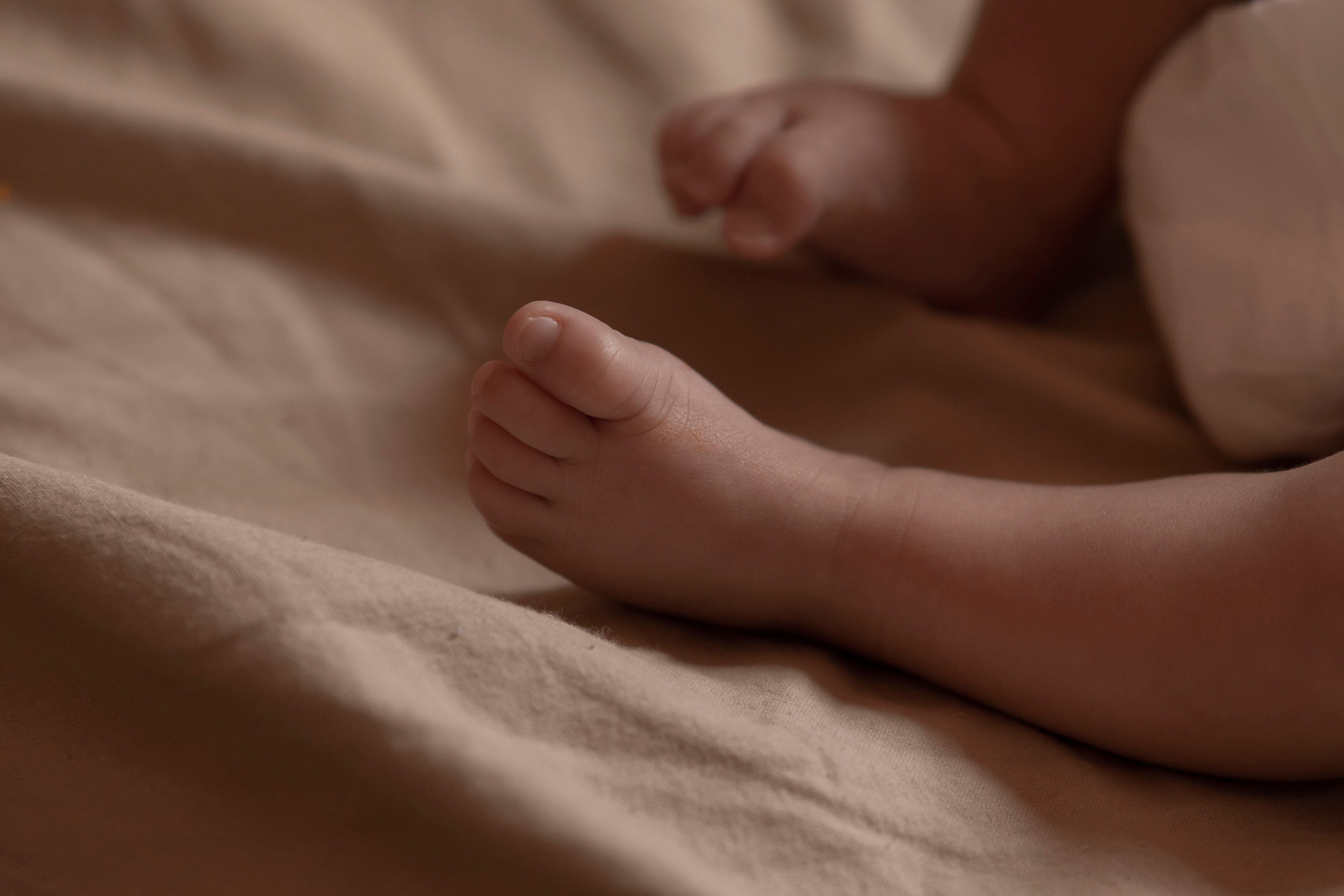 Understanding Sensitive Baby Skin: Signs, Causes, and Care