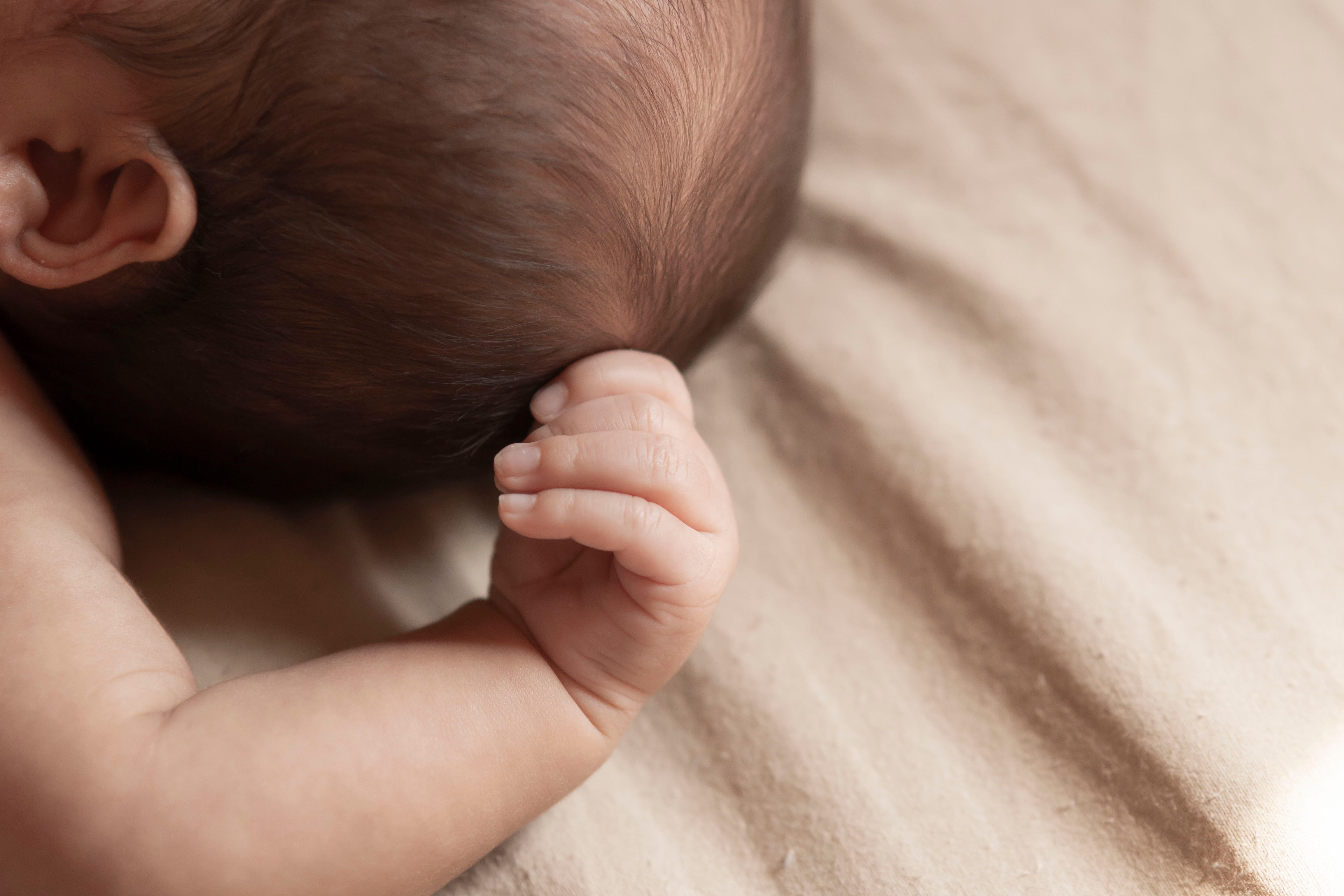 Ensefalokel Oksipital (Q01.2): Tinjauan Komprehensif dari Epidemiologi hingga Penatalaksanaan