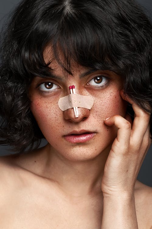 Woman with Broken Nose