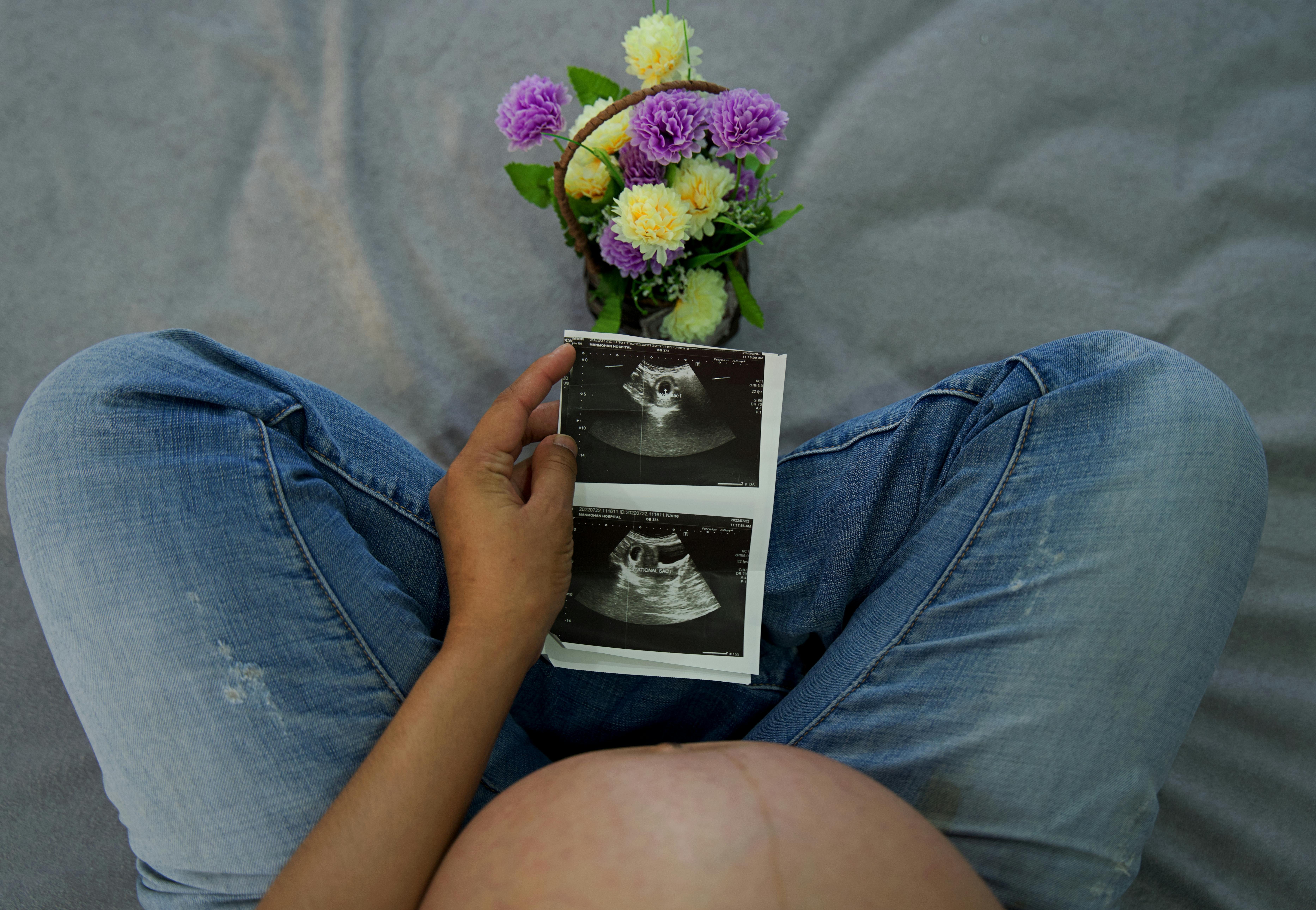 A pregnant woman holding ultrasound images with flowers, showcasing maternal joy.