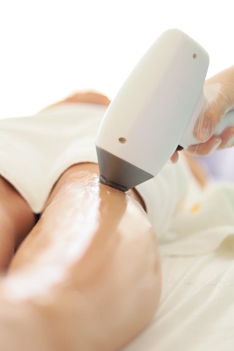 Woman During Laser Hair Removal 