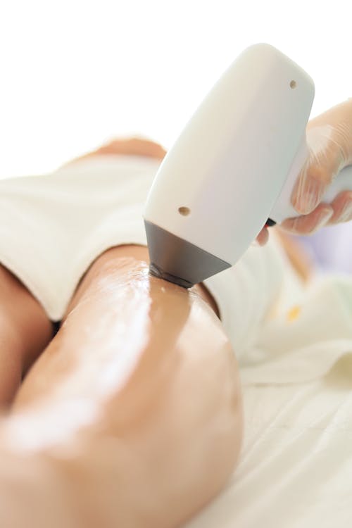 Free Woman during Laser Hair Removal  Stock Photo