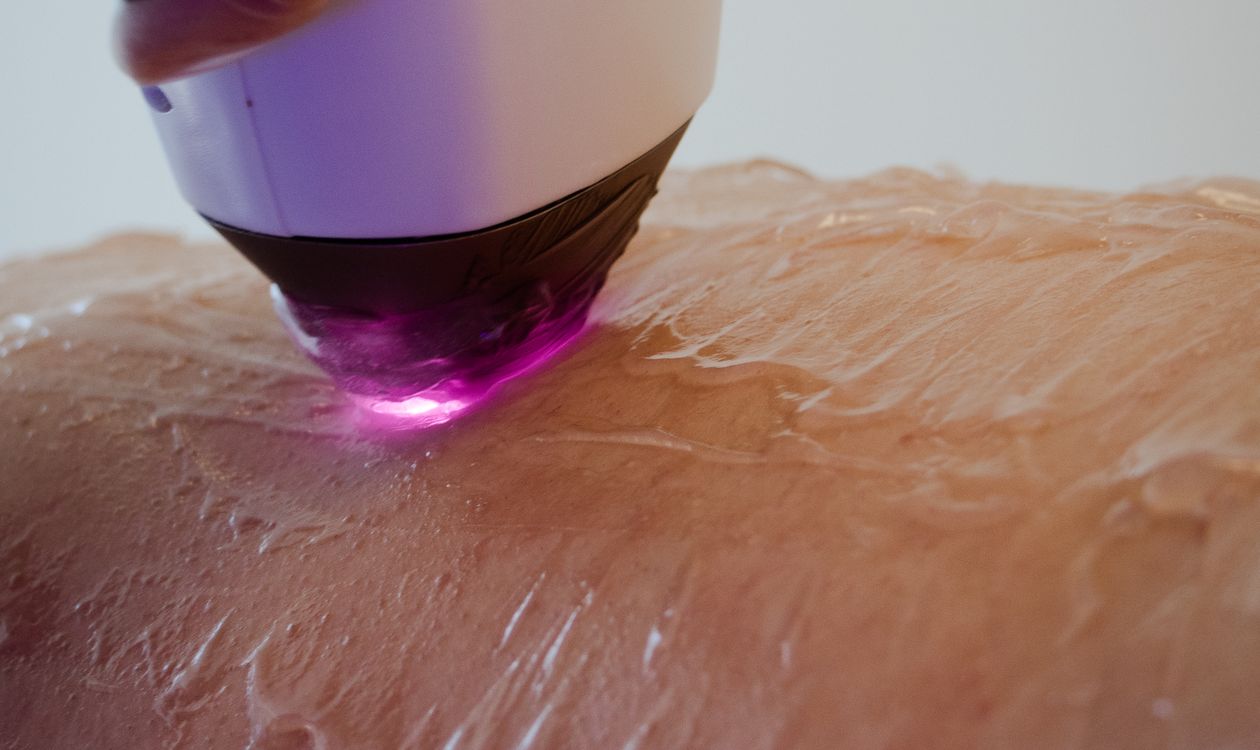 Cabezal de aparatología aplicado sobre la piel del rostro, radiofrecuencia facial en Sapphira Privé Montecarmelo