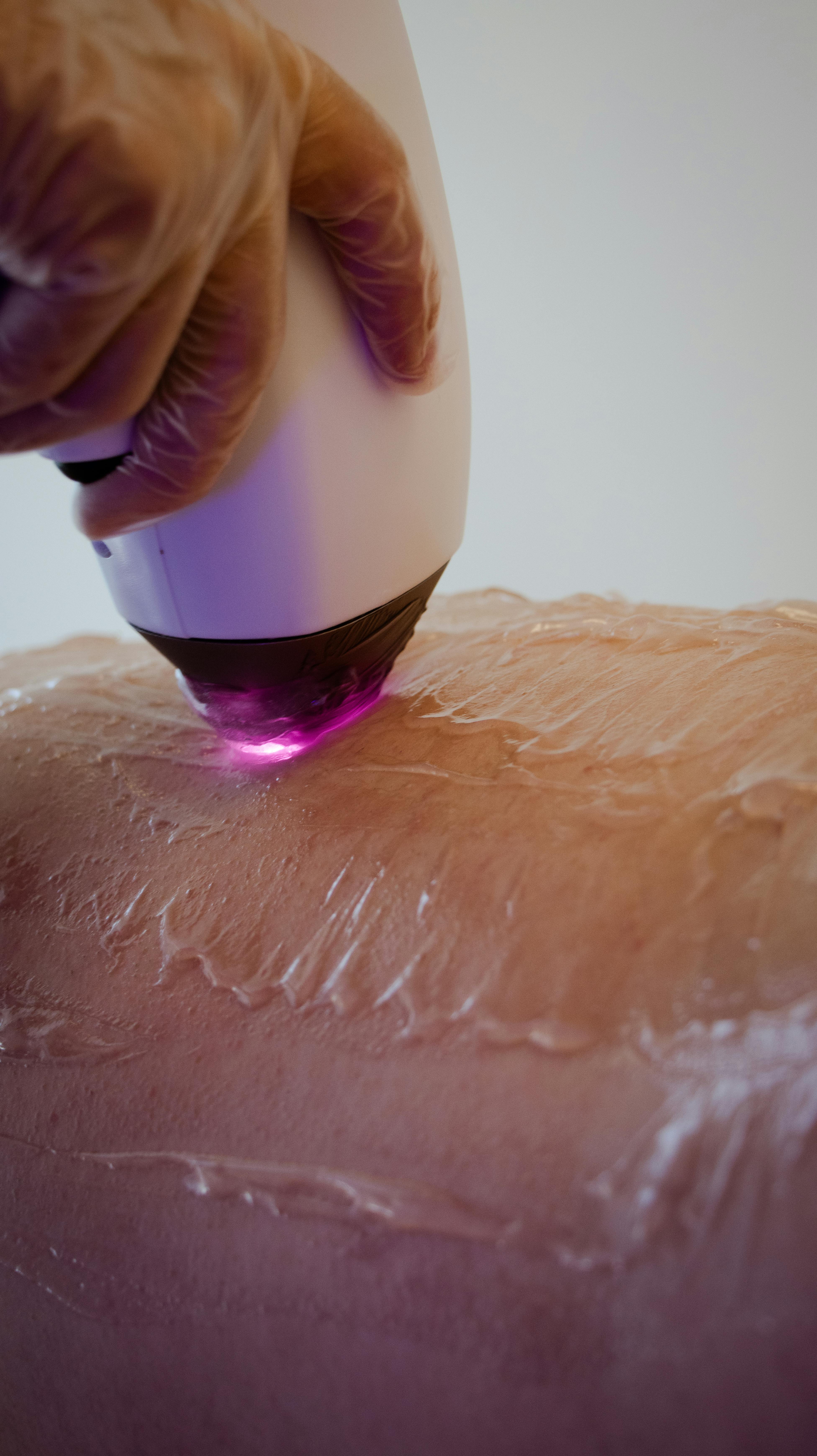 Smooth Confidence - The Complete Guide to Underarm Laser Hair Removal for Lasting Results