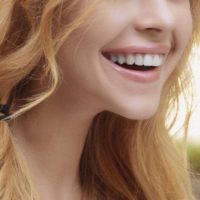 Resultado de tratamiento dental: sonrisa sana